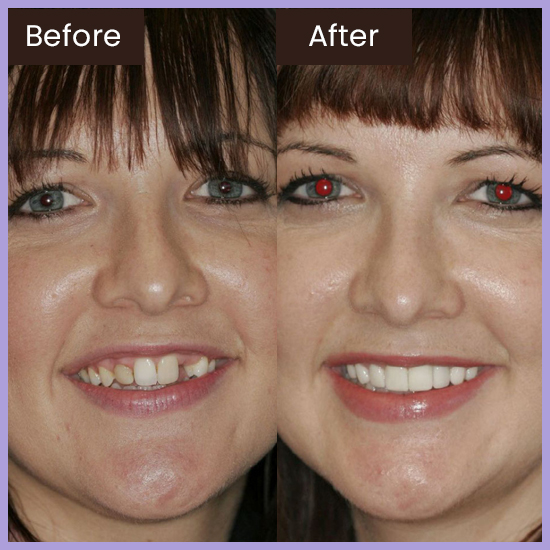 Smile Gallery Before and After Treatment Creative